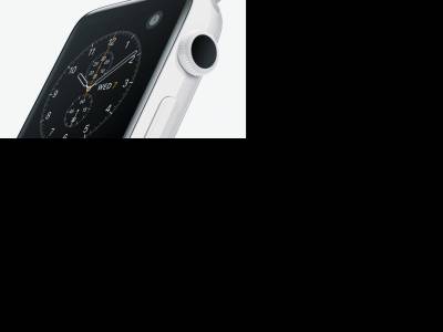 Kerámiaházas változatot kaphat az Apple Watch Series 12
